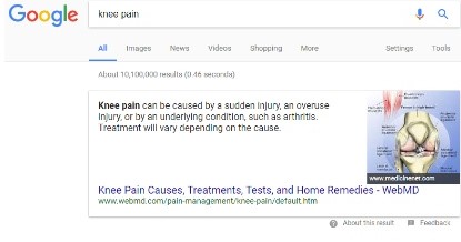 donnnes-structurees-rich-card